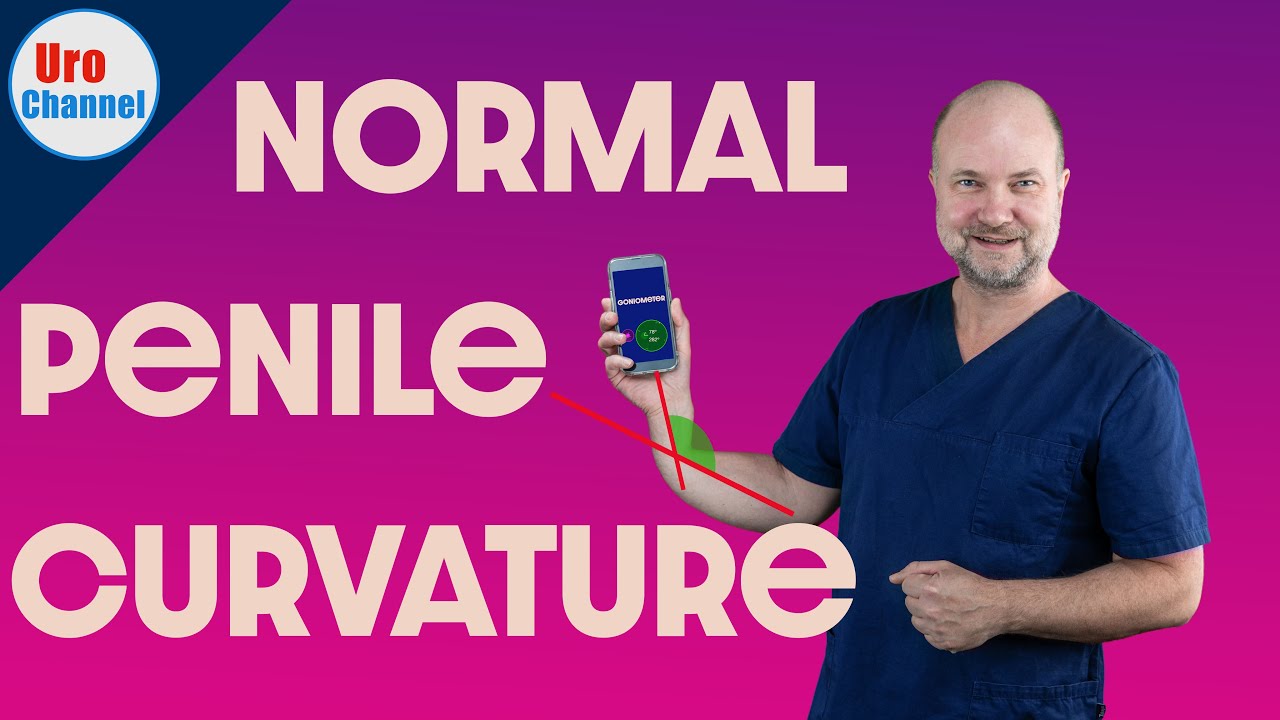 Normal penile curvature vs. Peyronie‘s vs. Chordee | UroChannel