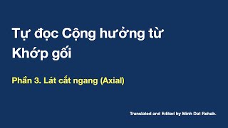 Tự đọc MRI khớp gối. Phần 3: Lát cắt ngang (Axial)