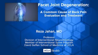 Facet Joint Degeneration: A Common Cause of Back Pain Evaluation and Treatment
