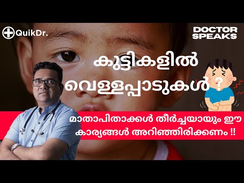 കുട്ടികളുടെ മുഖത്ത് വരുന്ന വെള്ളപ്പാടിന്റെ കാരണങ്ങളും പരിഹാരവും |White Patches on Baby 's Face