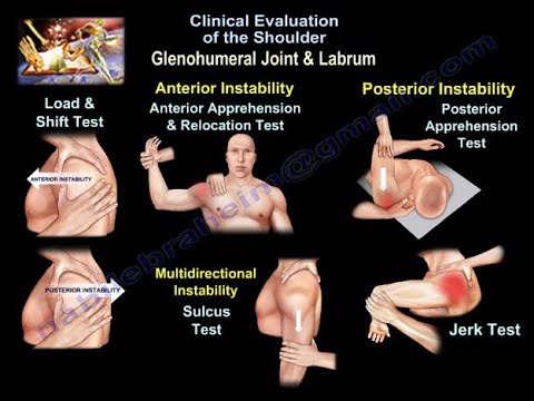 Clinical tests and examination of the  Shoulder  - Everything You Need To Know - Dr. Nabil Ebraheim