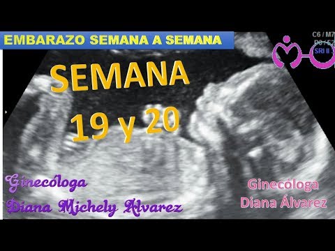 EMBARAZO SEMANA A SEMANA, SEMANA 19 Y 20, POR GINECOLOGA DIANA ALVAREZ