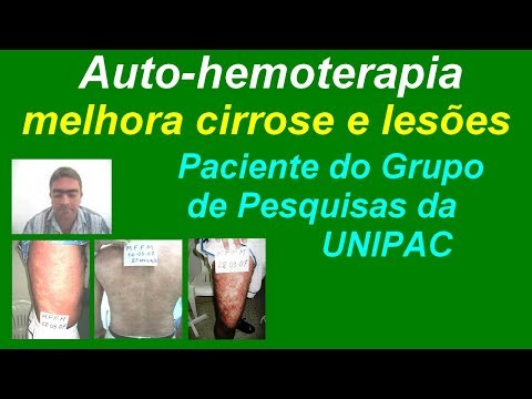 Cura di Podolsk di alcolismo su fonderia Centro di Domodedovo di cura di alcolismo