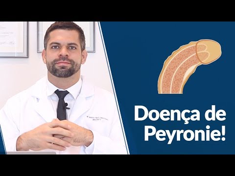 Weidenröschen in der Behandlung von Prostata-Adenom Wie Massage der Prostata