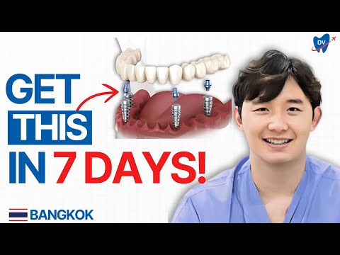 All on 4 Implants in Bangkok: Insider's Guide on Full Mouth Implants in Thailand