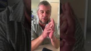 A patient's view of the CMMS Technique