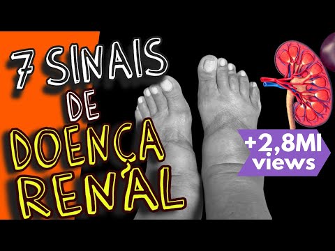 7 SINTOMAS QUE SEUS RINS PODEM NÃO ESTAR BEM (sinais de insuficiência renal)