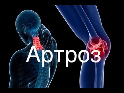 Лечение при артрозе коленного сустава комплекс упражнений Лфк при остеохондрозе поясничном отделе