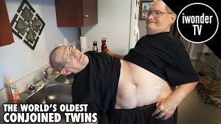 The Worlds Oldest Conjoined Twins Ronnie and Donnie Galyon