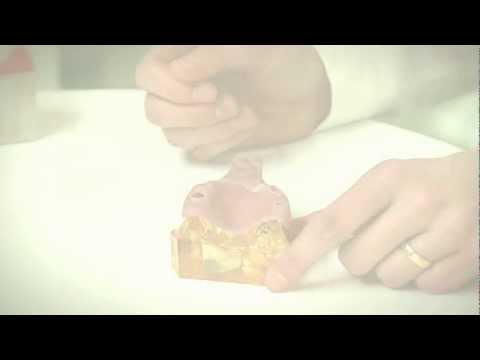 3. Behandlungsschritt: Abformung des Implantats