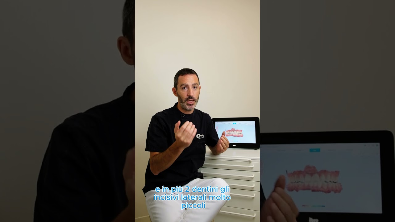 Ortodonzia con Invisaling e faccette estetiche