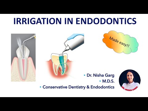 Płukanie w endodoncji - podchloryn sodu