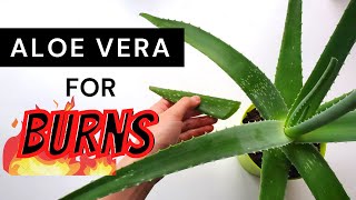 How to use fresh aloe vera plant for burns