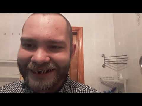 Перелом челюсти, шинирование, на сколько больно?