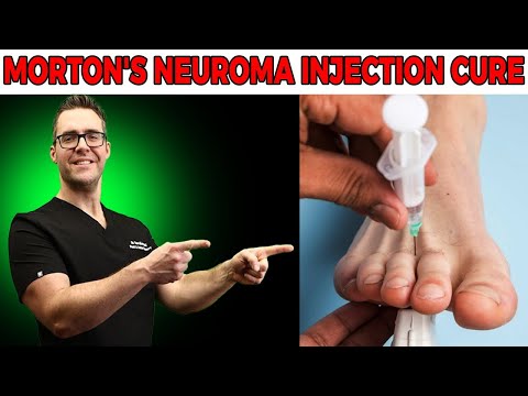 How To Treat Morton s Neuroma Foot Injection Research 2021