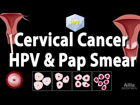 Cervical Cancer, HPV, and Pap Test, Animation