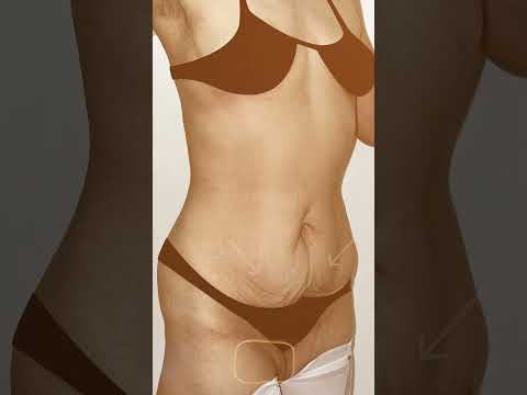 Video Resultado Dr. Acosta