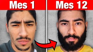 Así sería tu BARBA si Usas MINOXIDIL / Cuanta BARBA CONSIGUES en 1 Año