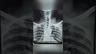 Dr. Jayant Manchanda Healing Video Gallery 3