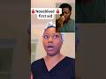 Nosebleed Emergencies Immediate Action Health Wellnessforlife Wellness Emergency Nosebleed