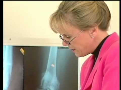 Simptome de artroză și tratamentul articulației umărului
