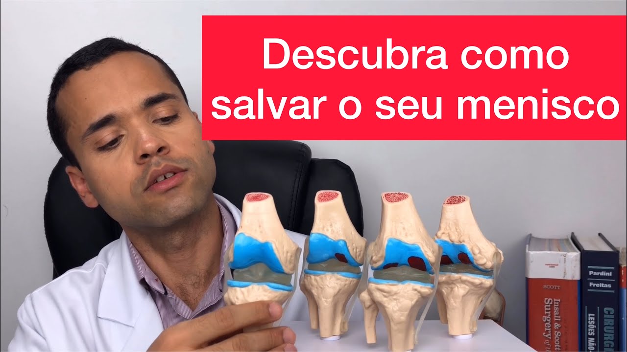 Descubra como salvar o seu menisco