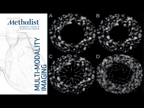 Echo Assessment of LV Function: EF, Strain, Cardio-oncology (Miguel Quiñones, MD ) October 15, 2019