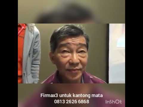 Jintan hitam untuk potensi Ia membuka cowok video yang