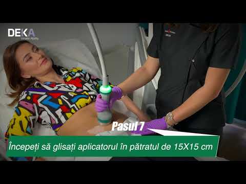 Onda Coolwaves - DEKA Laser - DEMO Tratament Grăsime Localizată