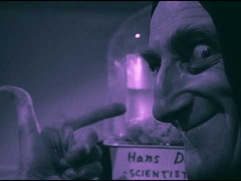 AvalmateK  Accident Celebral