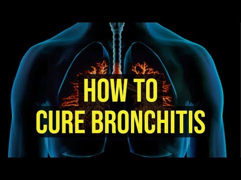 How To Cure Bronchitis Fast | 5 Quick Ways