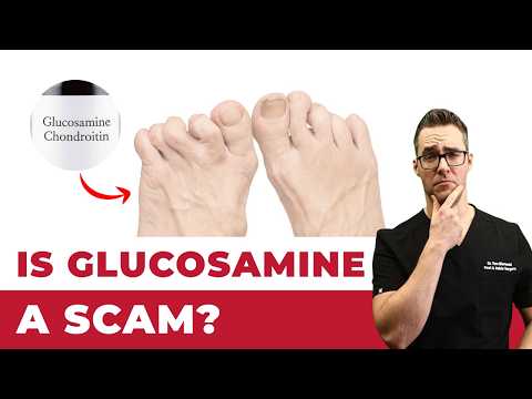 What Causes Bunions What is a bunion How Do You Get Bunions