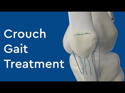 Watch lagu Images Videos Cerebral Palsy Called Diplegia, Watch Images Cerebral Palsy Called Diplegia free Watch, Watch Images Cerebral Palsy Called Diplegia