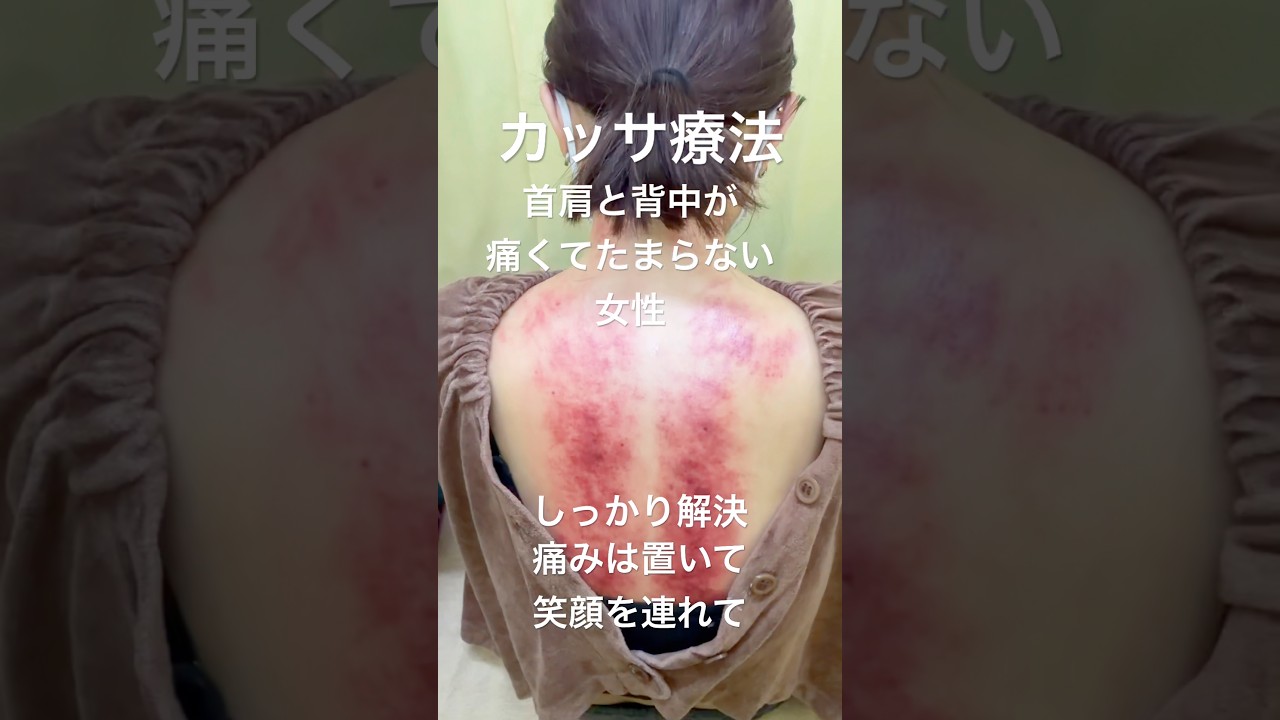 【背中の癒着をとる⁉️】カッサ療法‼️