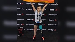 Teen Gymnast Defies the Odds After Losing Her Leg to Cancer