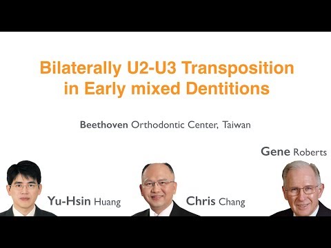 CC443. Bilaterally U2-U3 Transposition in Early mixed Dentitons