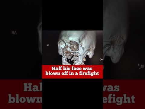 On this day 7 years ago, Major Rishi Rajalekshmy’s face was blown off #ltcolrishirajalakshmi