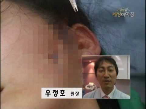 JJ Miracle lift broadcasted on KBS TV program