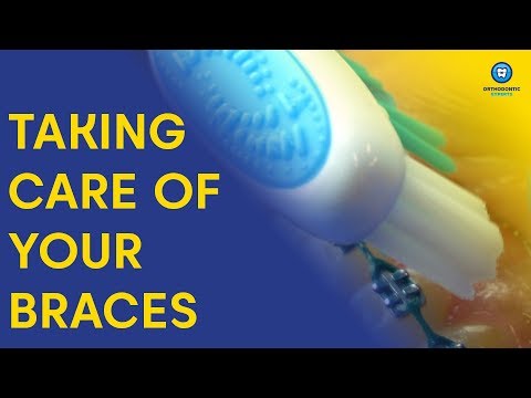 Braces Survival Guide | How To Care For Your Braces