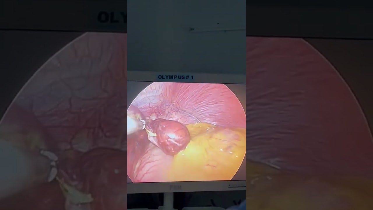 Alexander Alonso Lázaro Chumbe-25