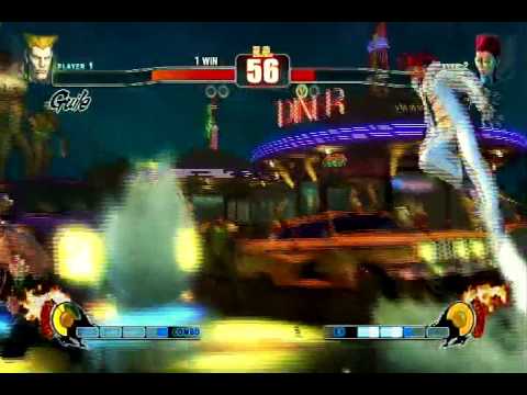 Dagger G vs Shigz 2nd match