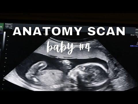 BABY 4 ANATOMY SCAN!! ANATOMY SCAN 19 WEEKS PREGNANT & BABY UPDATE
