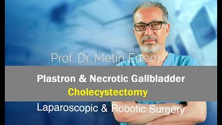 Miniaturka - Plastron and Necrotic Gallbladder. Metin Ertem MD.FACS.