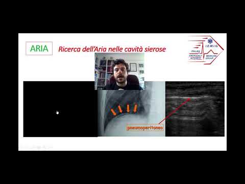 Ecografia Bed Side dott.  Francesco De Antoniis 2