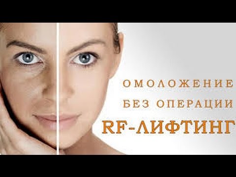 Хочу побольше веснушек Пигментные пятна после родов. и как от них избавиться