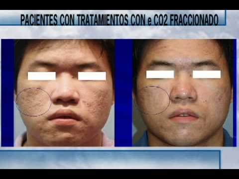 Armando Escobar Juyo-95
