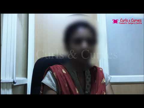 Breast Augmentation Patient