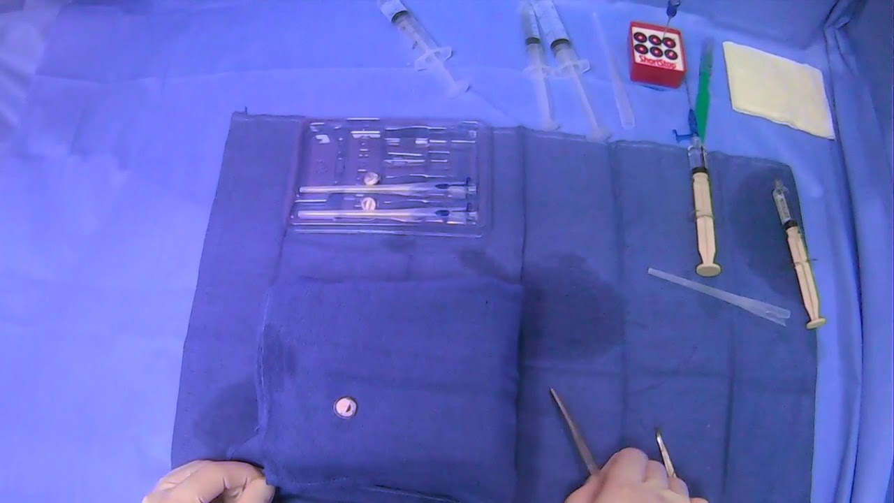 Watch video Removing Gastrointestinal Anchors (T-Fasteners/T-Pexy Devices) Now Removing Gastrointestinal Anchors (T-Fasteners/T-Pexy Devices)