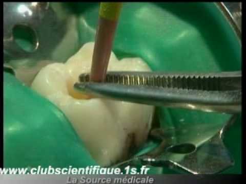comment traiter grossesse molaire