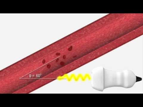 biofotonok a visszér ellen gipsz visszérgyulladás kezelésére